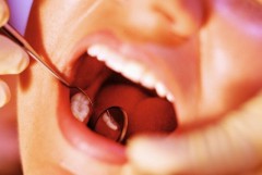 В Польше стоматолог отомстила за измену - вырвала экс-жениху все зубы