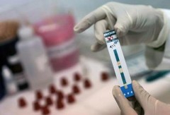 В Сочи бесплатно проведут экспресс-тесты на ВИЧ