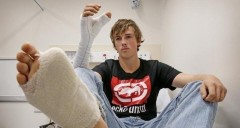 Австралийцу хирурги пересадили большой палец ноги на руку