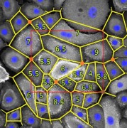 Компьютерное зрение сможет точнее выявлять рак по характеру клеточного узора - ученые ЮФУ